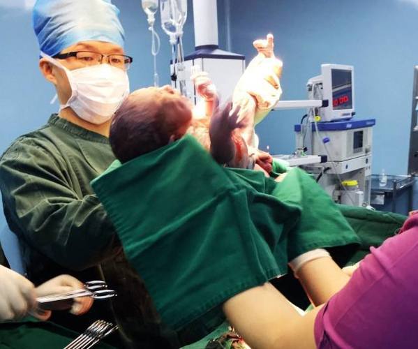 为何产科让男医生接生,不怕孕妈难为情吗?真相孕妇需知晓