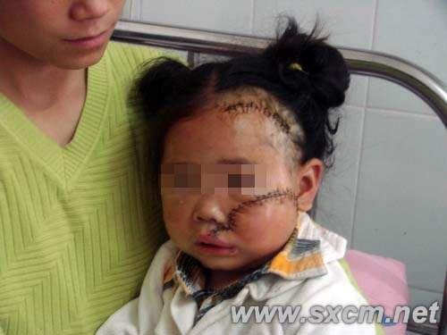 精神病女子割开3岁女童脸部后哈哈大笑(图)