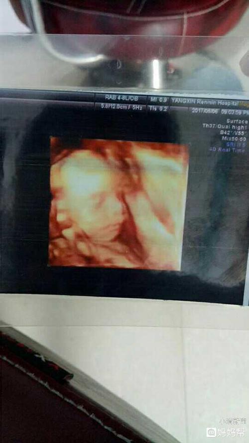 这是23周三维照片,像男孩,还是女孩 - 2017年10月出生