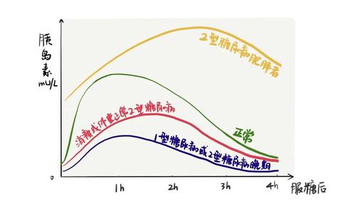 (1)胰岛素分泌 减少型
