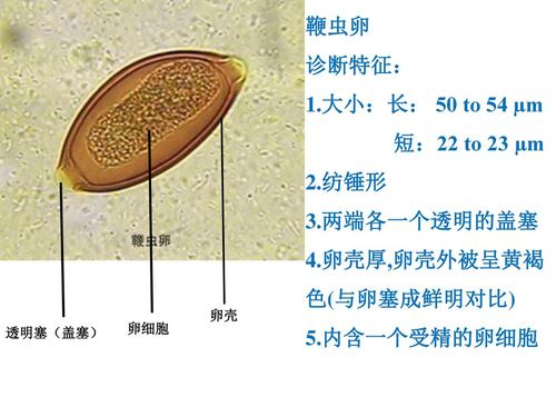卵壳厚,卵壳外被呈黄褐色(与卵塞成鲜明对比) 鞭虫卵诊断特征:大小