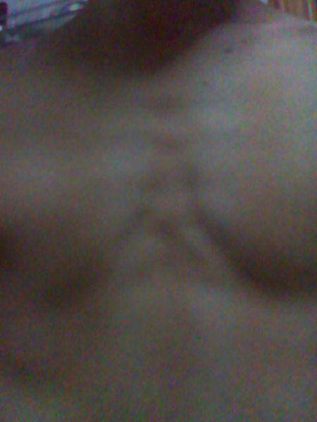 我"这属于胸部凹陷吗?