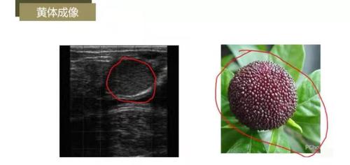 卵泡成像:2个卵泡;1个发情卵泡,直径在2cm左右.