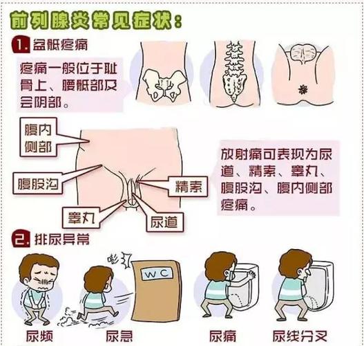 前列腺炎 您不能视而不见 尿频尿急尿痛尿不尽.