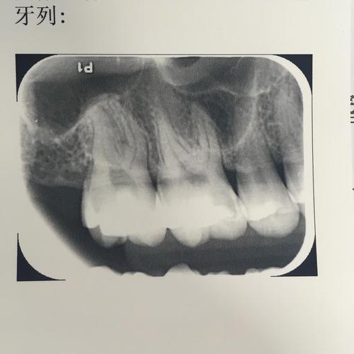 有人能教教我怎么看牙齿的x光片吗?