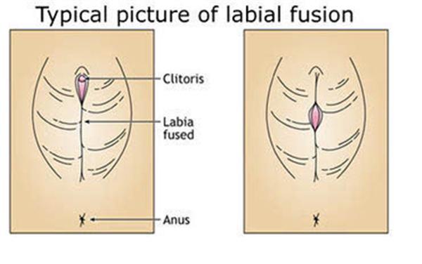 外阴护理女宝篇正常清洗忌过度
