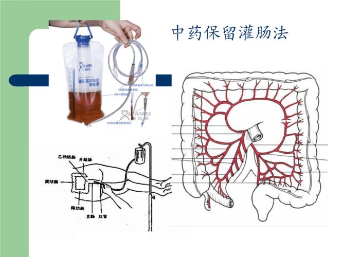 中药灌肠疗法的作用机理.ppt 35页