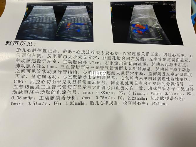 胎儿超声心动图一次过～_胎儿_产检_母婴_孕产经验