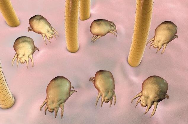 网易首页>网易号>正文申请入驻> 螨虫是一种寄生虫,除了在床上,它们更