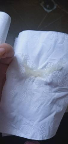 水样白带是怎么回事下面突然流了很多透明的液体是什么