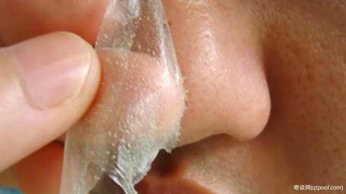 鼻头里的白条是螨虫吗?看这里1眼辨别