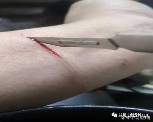 3月16日凌晨三桥派出所接到一名女子的报警,她说自己的男朋友正在割腕