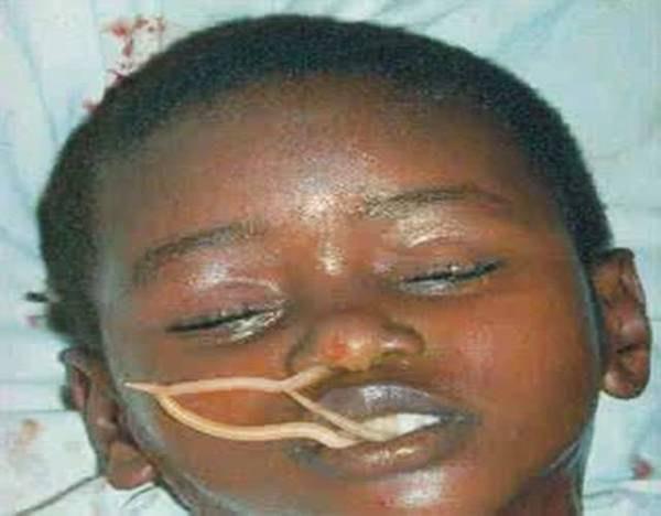 小孩几岁打蛔虫,多久打一次?