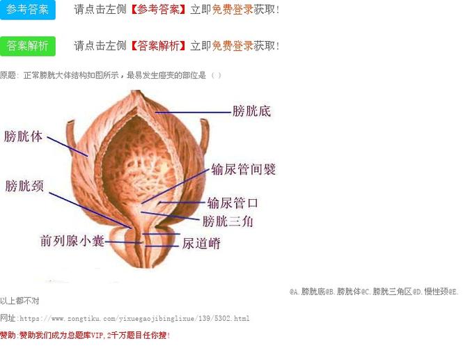 正常膀胱大体结构如图所示,最易发生癌变的部位是 ( )