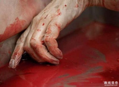 探秘法医解剖室中处理人体的真实场景