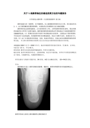 x线跟骨轴位的最佳投照方法以及对跟骨骨折临床诊断的价值.doc