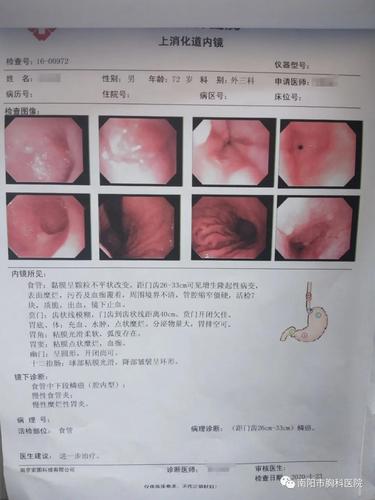 南阳胸科医院食管癌治疗