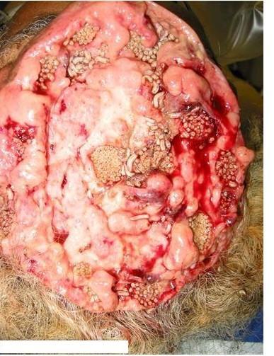 关于寄生虫和血寄虫的手抄报 手抄报简单又好看