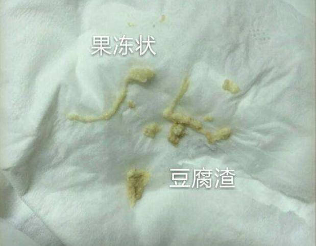 一般是子宫里面的环境不太好了,有炎症或者病变,脓性物质是捎带黄色的