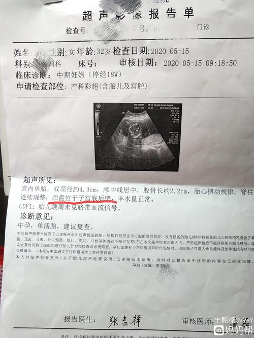 胎盘位于子宫底后壁正常吗?