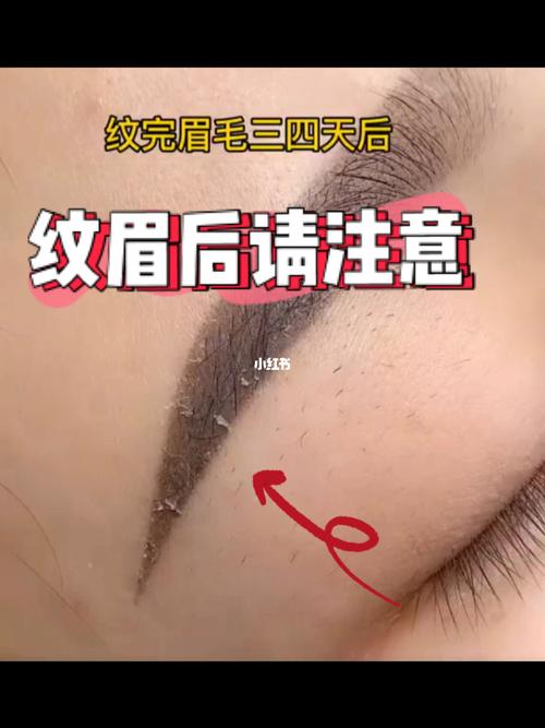 纹眉后会结痂吗?来看看_纹眉_纹绣_佛山市攻略_半永久