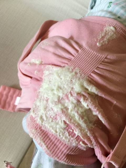 宝宝吐奶…大量怎么办,有图片,理解下,有没有懂的?