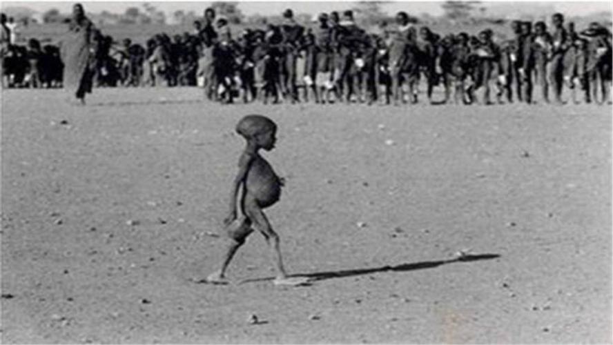 骨瘦如柴的大肚儿童