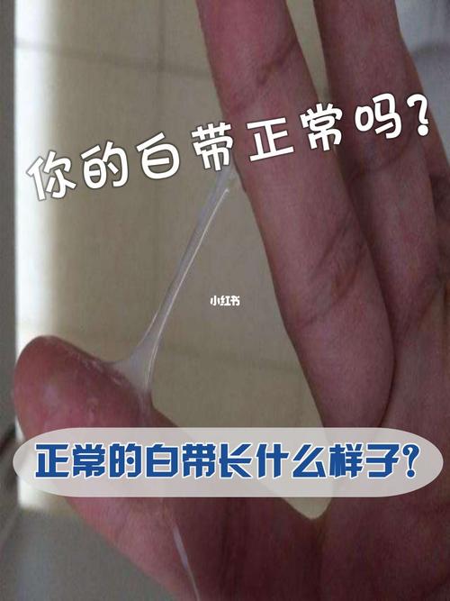 健康白带长这样!不是就要小心妇科问题!_妇科_排卵期