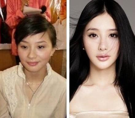 整容失败的十大明星:熊乃瑾