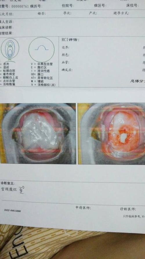23,未婚,医生说宫颈糜烂3度,提问只会上传一张图,医生说就是炎症,建议