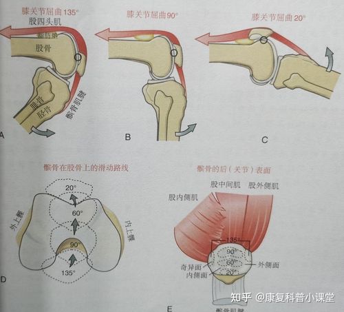 膝关节屈曲10-20°时,髌骨下级内外侧关节面同时与股骨滑车相接触