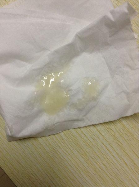 问:精子颜色偏黄是什么原因?