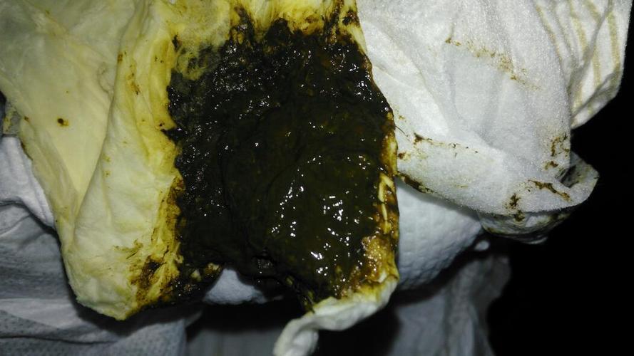 宝宝出生第六天了,拉的便便还是褐色