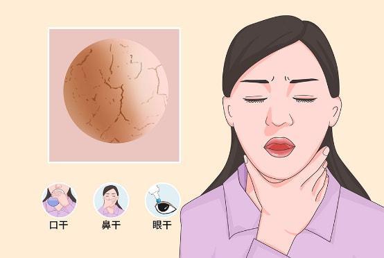 "干燥综合征"在人体各个部位的变化!