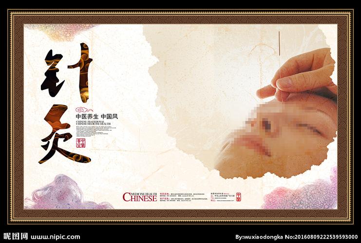针灸图片