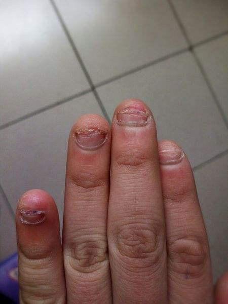 孩子出现这种"怪癖",及时补锌是良策,莫把"缺锌"当"怪病"