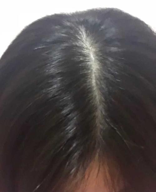 天生自然卷,沙质头发,而且还多且蓬松,怎么能让头发柔顺一点且直一点?