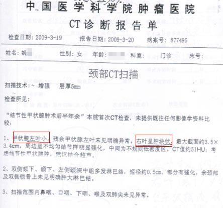 术后半年ct诊断报告显示甲状腺左叶小,右叶呈肿块状.
