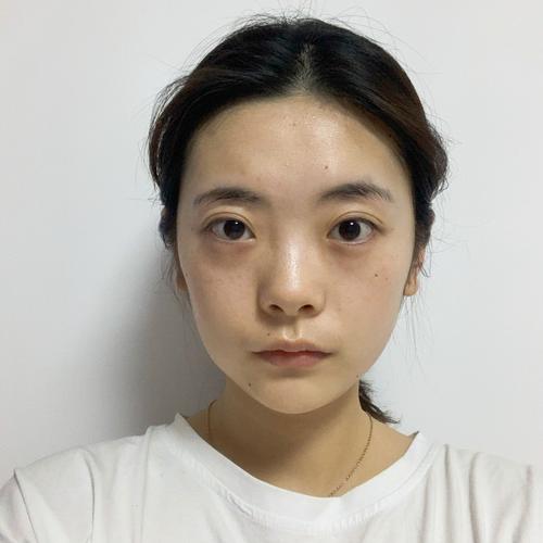 虽然长了一副娃娃脸,但是脸颊有斑还是蛮显倦容的,再加上经常熬夜