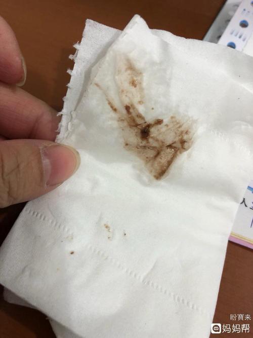 子宫内膜炎,月经干净后老是有分泌物