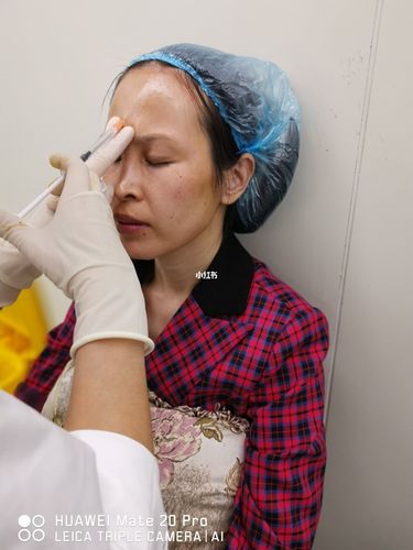 虞美人瓷娃娃变美进行中