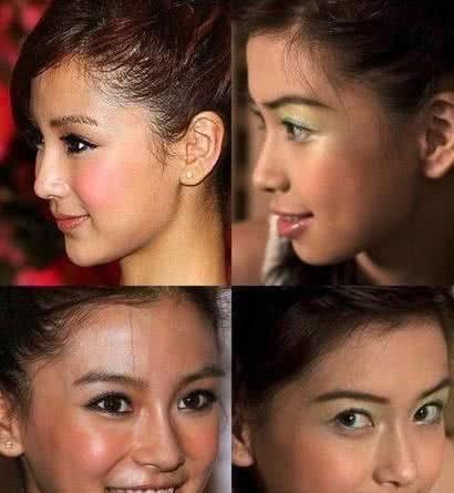 杨颖15岁丑照曝光被质疑整容,回应:早知道整牙时不拍那么多照片