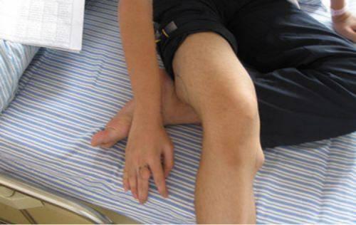 这些食物别再给孩子吃了,又一个6岁孩子患上骨癌晚期.