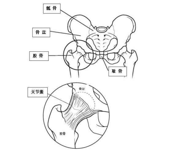 髋骨或股骨的坏死确实会导致髋关节疼痛,但并不是所有的髋关节疼痛都