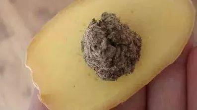 你体内这么寒,不胖才怪!艾灸4穴,祛寒又减肥!