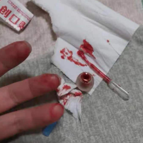 血淋淋的伤口,被血迹浸染的创可贴,在纸巾上晕开的血液.