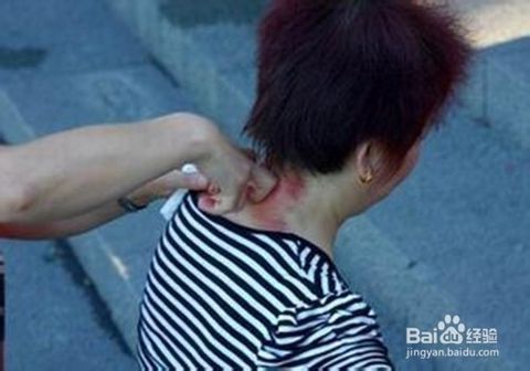 6  如果出汗不行,还可以扯痧,也就是中指食指并起弯曲,揪鼻梁,咽喉