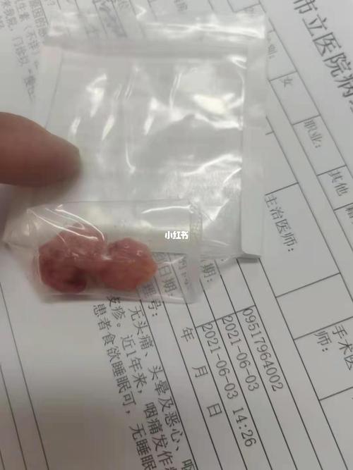 扁桃体切除_扁桃体_医疗健康_医疗健康其他