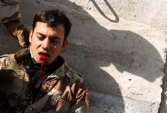 超强士兵,伊拉克士兵中枪子弹穿嘴而过仅造成皮肉伤