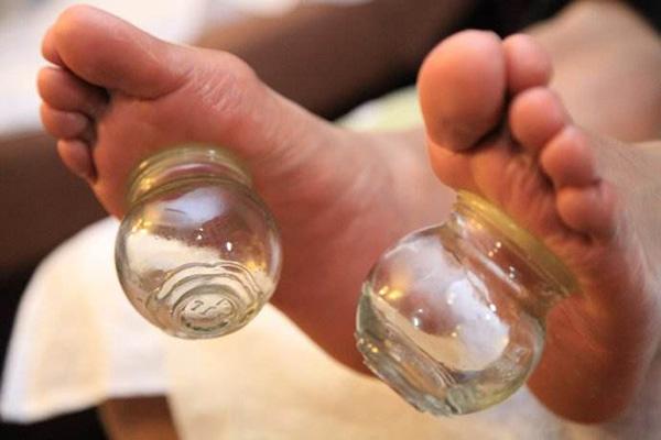 脚底拔火罐有什么好处 脚底拔罐的注意事项有哪